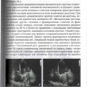 Пример страницы из книги "Практикум по эхокардиографии" - Зимина Ю. В., Воробьева А. С.