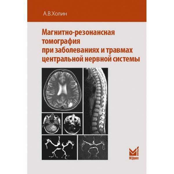 Магнитно-резонансная томография при заболеваниях и травмах центральной нервной системы  - Холин А. В.