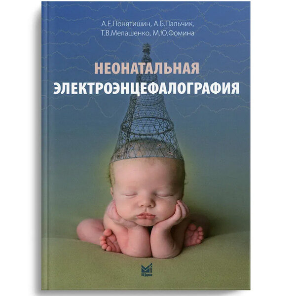 Неонатальная электроэнцефалография - А. Е. Понятишин, А. Б. Пальчик, Т. В. Мелашенко, М. Ю. Фомина