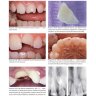 Пример страницы из книги "Детская стоматология" - Антонелла Полимени