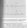 Пример страницы из книги "Быстрый анализ ЭКГ" - Хан М. Г.