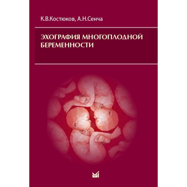 Эхография многоплодной беременности - Костюков К. В., Сенча А. Н.