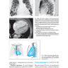 Пример страницы из книги "Лучевые методы диагностики болезней сердца" - Телен М.