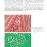 Пример страниц из книги "Кольпоскопия в деталях. С рисунками и схемами" - Минелло Дж.