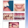 Пример страницы из книги "Травмы зубов. Наглядное пособие" - Алани А., Кэлверт Г.