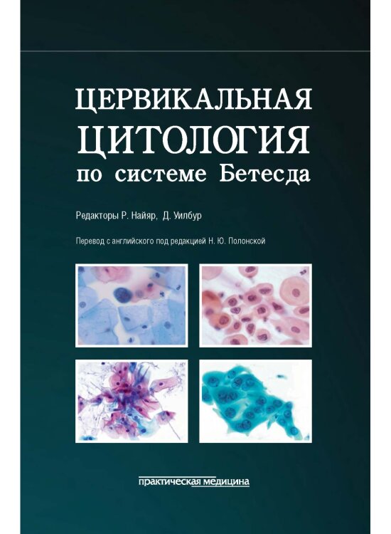 Цервикальная цитология по системе Бетесда. Терминология, критерии и пояснения - Р. Найяр, Д. Уйлбур