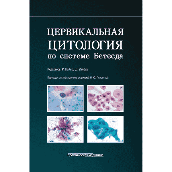 Цервикальная цитология по системе Бетесда. Терминология, критерии и пояснения - Р. Найяр, Д. Уйлбур