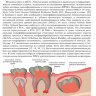 Пример страниц из книги "Регенеративная стоматология. Научно обоснованный подход" - С. Хоссейнпур, Л. Дж. Уолша, К. Мохарамзаде