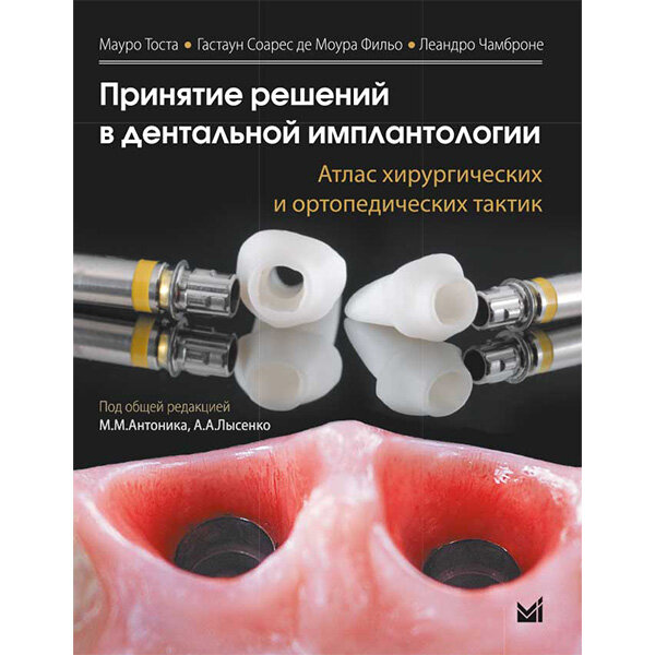 Принятие решений в дентальной имплантологии. Атлас хирургических и ортопедических тактик - Мауро Тоста, Гастаун Соарес де Моура Фильо, Леандро Чамброне