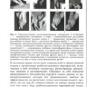​Пример страницы из книги "Руководство по реабилитации после оперативного лечения статических деформаций переднего отдела стопы" - Карданов А. А.