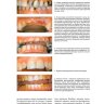 Пример страницы из книги "Коронки и мостовидные протезы в ортопедической стоматологии" - Смит Бернард