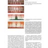 Пример страницы из книги "Коронки и мостовидные протезы в ортопедической стоматологии" - Смит Бернард