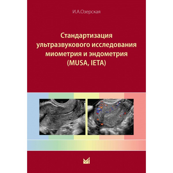Стандартизация ультразвукового исследования миометрия и эндометрия (MUSA, IETA) - И. А. Озерская