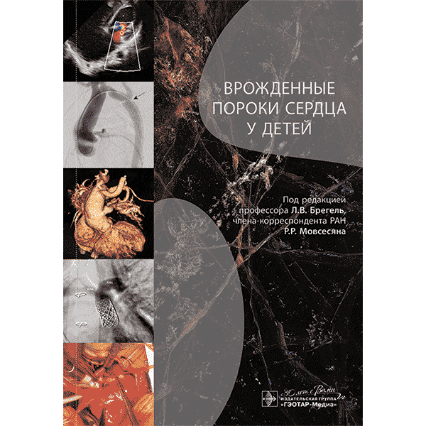 Врожденные пороки сердца у детей. Руководство для врачей - Л. В. Брегель, Р. Р. Мовсесяна