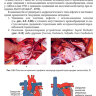 Пример страницы из книги "Врожденные пороки сердца у детей. Руководство для врачей" - Л. В. Брегель, Р. Р. Мовсесяна