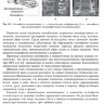 Пример страницы из книги "Повреждения и заболевания позвоночника" — А. А. Лака