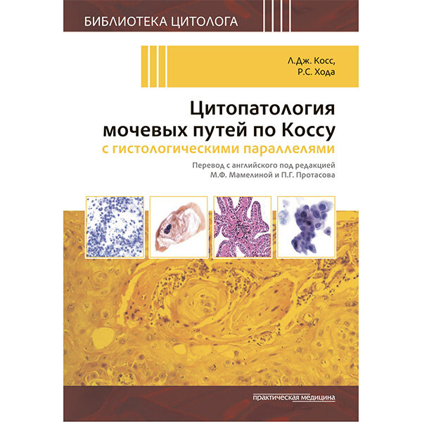 Цитопатология мочевых путей по Коссу с гистологическими параллелями - Косс Л.Дж., Хода Р.С.