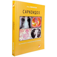 Саркоидоз. Роль ренгенолога в мультидисциплинарном консилиуме - Сперанская А. А.