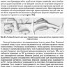 Пример страницы из книги "Техника и принципы хирургического лечения заболеваний и повреждений позвоночника" — А. В. Басков, И. А. Борщенко, В. А. Басков