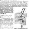 Пример страницы из книги "Техника и принципы хирургического лечения заболеваний и повреждений позвоночника" — А. В. Басков, И. А. Борщенко, В. А. Басков