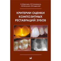 Критерии оценки композитных реставраций зубов - Николаев А. И.