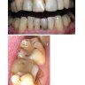 Пример страницы из книги "Критерии оценки композитных реставраций зубов" - Николаев А. И.