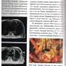 Пример страницы из книги "Кардиохирургия. Уровень доказательности экспертный" - Дземешкевич С. Л.