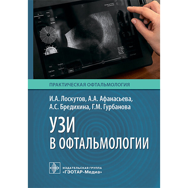 УЗИ в офтальмологии - Лоскутов И. А., Афанасьева А. А., Бредихина А. С., Гурбанова Г. М.