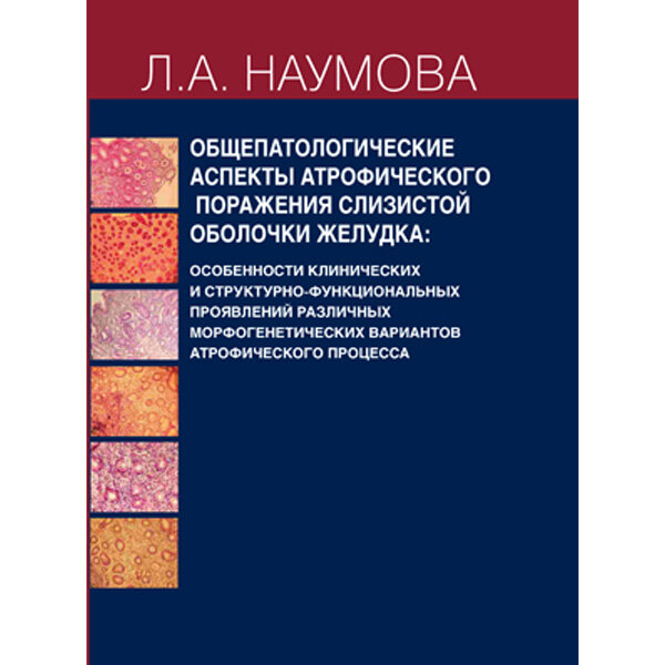 Общепатологические аспекты атрофического поражения слизистой  оболочки желудка - Наумова Л. A.