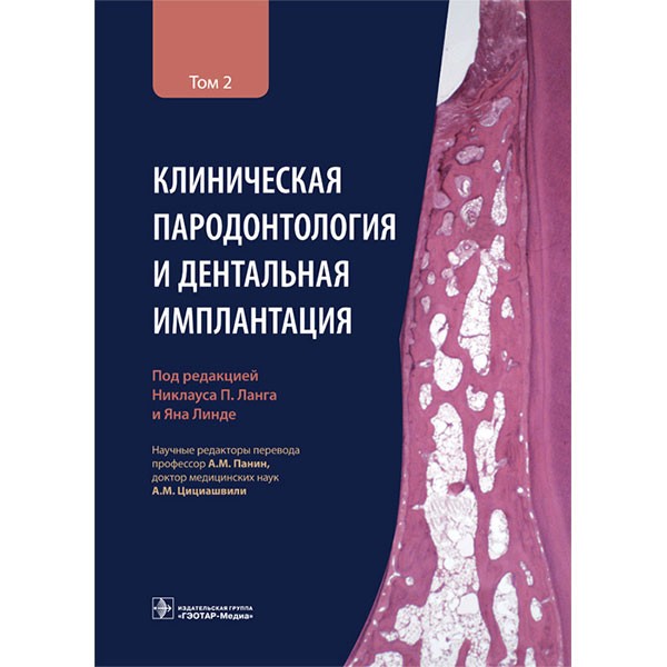 Клиническая пародонтология и дентальная имплантация. В 2-х томах. Том 2 -  Н. П. Ланга
