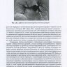 Пример страницы из книги "Хирургическое лечение хронической тромбоэмболической легочной гипертензии" - А. М. Чернявский, А. Г. Едемский, Н. В. Новикова