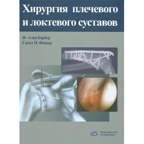 Хирургия плечевого и локтевого суставов - Барбер Ф. А., Фишер С. П.