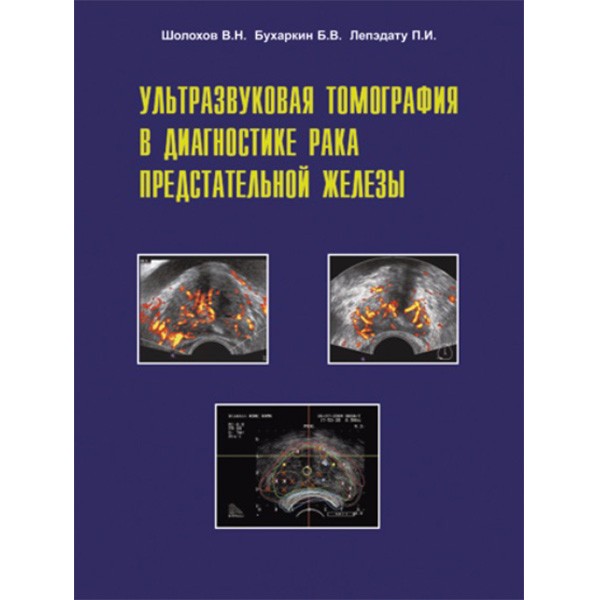 Ультразвуковая томография в диагностике рака предстательной железы - В. Н. Шолохов