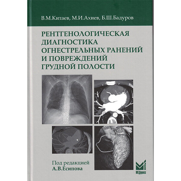 Рентгенологическая диагностика огнестрельных ранений и повреждений грудной полости - В. М. Китаев, М. И. Ахиев, Б. Ш. Бадуров