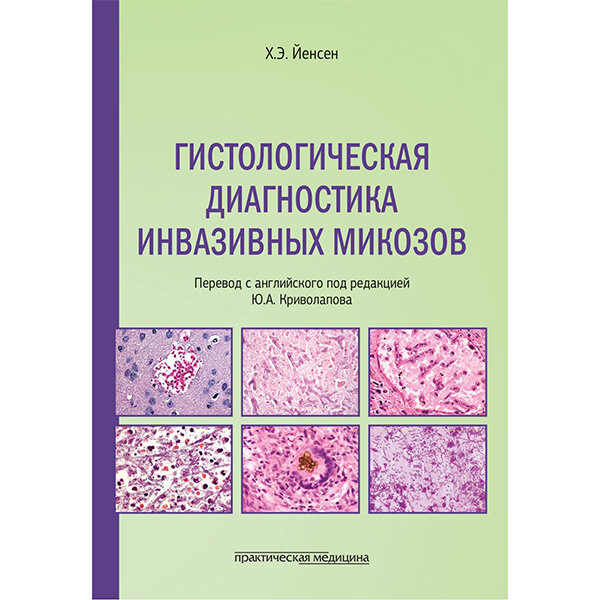 Гистологическая диагностика инвазивных микозов - Х. Э. Йенсен 
