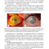 Пример страницы из книги "Ожоги глаз. Состояние проблемы и новые подходы" - Черныш В. Ф., Бойко Э. В.