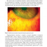 Пример страницы из книги "Ожоги глаз. Состояние проблемы и новые подходы" - Черныш В. Ф., Бойко Э. В.