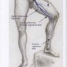 Пример страницы из книги "Ультразвуковое исследование вен нижних конечностей: анатомия, рефлюксы, тромбозы и хирургические подходы"- К. В. Мазайшвили