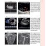 Пример страницы из книги  "Диагностическая визуализация в гинекологии: в трех томах" Том 3 - Шаабан А. М.