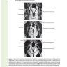 Пример страницы из книги  "Диагностическая визуализация в гинекологии: в трех томах" Том 3 - Шаабан А. М.