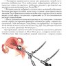 Пример страницы из книги "Внутриматочная патология: клиника, гистероскопическая диагностика и лечение" - Рудакова Е. Б.