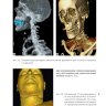 Пример страницы из книги "Судебно-медицинская радиология. От идентификации личности до посмертной визуализации" - Ло Ре Дж., Арго А., Мидири М.