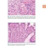 Примеры страниц из книги "Интерпретация биопсий пищеварительного тракта. Том I. Неопухолевые болезни" - Монтгомери Э. А., Вольтаджо Л.
