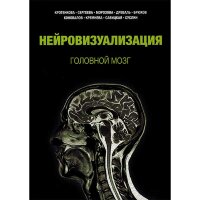 Нейровизуализация. Головной мозг - Кротенкова М. В., Сергеева А. Н., Морозова С. Н., Древаль М. В