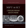 Книга "МРТ и КТ. Секционная анатомия"

Авторы: Андерсон М. В., Фокс М. Дж.

ISBN 978-5-91839-100-6