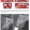 Примеры страниц из книги "Несостоятельность дентальной имплантации. Руководство по профилактике, лечению и поддерживающей терапии" - Томас Дж. Уилсон-мл, Стивен Хэррел
