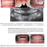 Пример страницы из книги "Ортодонтия. Ортодонтические аппараты при лечении зубочелюстных аномалий" - Персин Л. С., Слабковская А. Б.