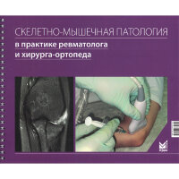 Скелетно-мышечная патология в практике ревматолога и хирурга-ортопеда - Лила А. М.