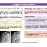 Пример страницы из книги "Скелетно-мышечная патология в практике ревматолога и хирурга-ортопеда" - Лила А. М.