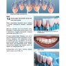 Пример страницы из книги "Нанесение керамической массы. Передние и боковые зубные протезы" - Джон Несс